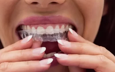 Invisalign Hawthorne: Clear Aligner Therapy for Discreet Orthodontic Correction